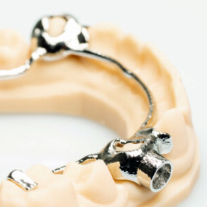 Polissage de Prothèses Dentaires en Orthodontie 